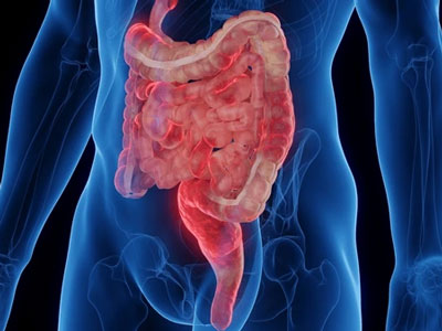 Why Isn’t My IBD Treatment Working?