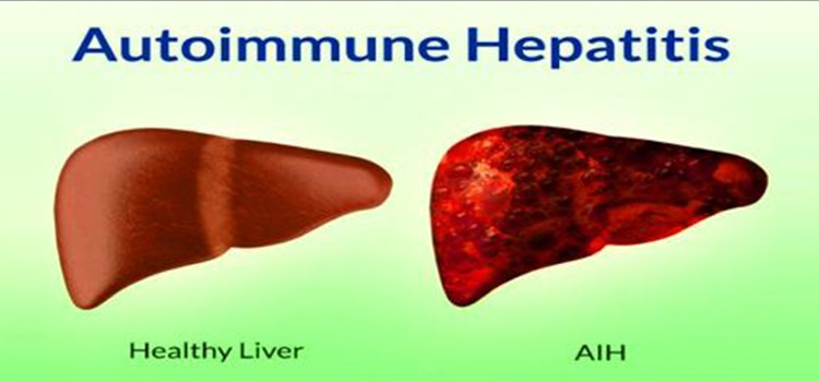 Autoimmune Hepatitis Dr Kiran Peddi